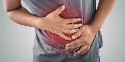 Colitis & Ulcerative Colitis (2) Colitis & Ulcerative Colitis (2)