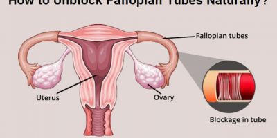 fallopian tube blockage